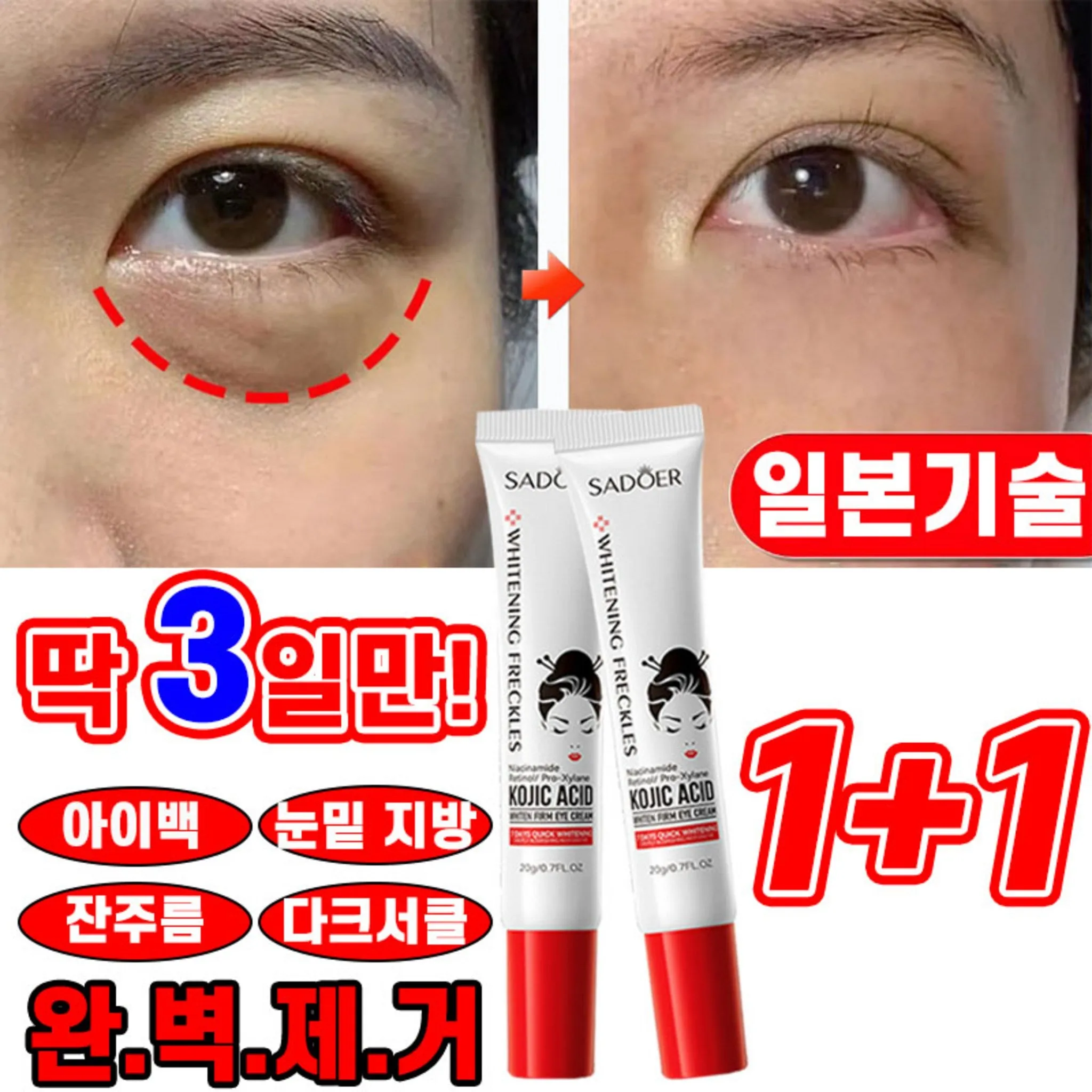 [3-Day Effect Guaranteed] Japan Eye Cream for Removal of Milia, Eye Bags, Dark Circles, Puffiness, and Wrinkles with Collagen, 20g, 2 Pack - 🏆 #3 - Beauty - Best of December