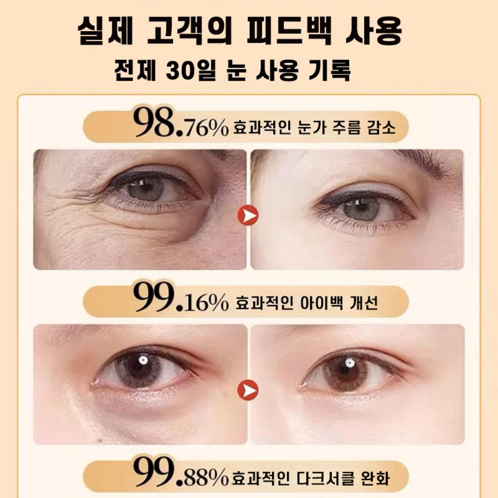 [3-Day Effect Guaranteed] Japan Eye Cream for Removal of Milia, Eye Bags, Dark Circles, Puffiness, and Wrinkles with Collagen, 20g, 2 Pack - 🏆 #3 - Beauty - Best of December