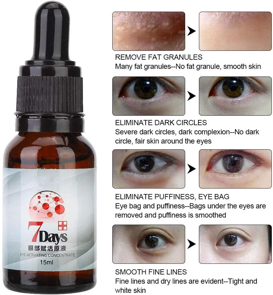 7 Days Anti Fat Eye serum Dark Circles Remove Anti Wrinkle Eye