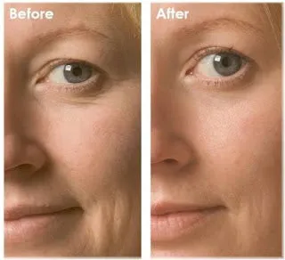 Anti-Aging Face Pearls