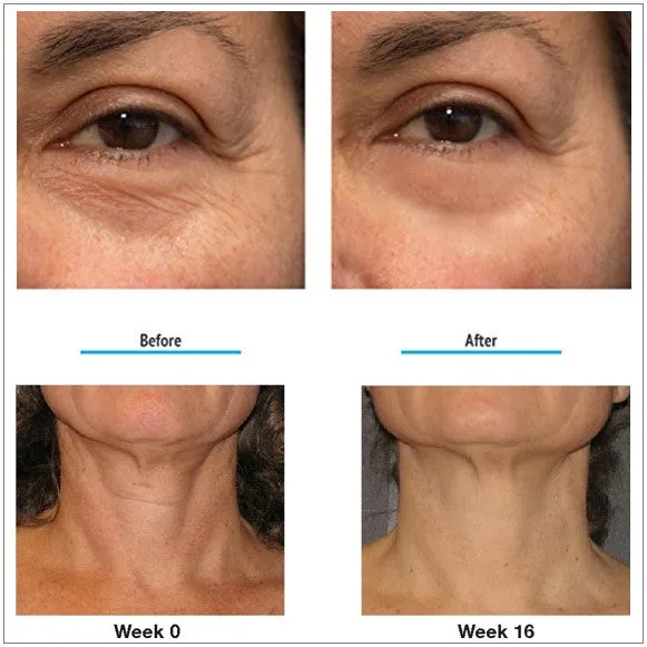 Anti-Aging Face Pearls