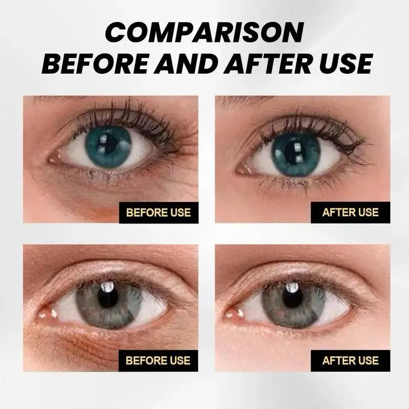 Anti Wrinkle Anti Dark Circle Eyes Cream 15ml