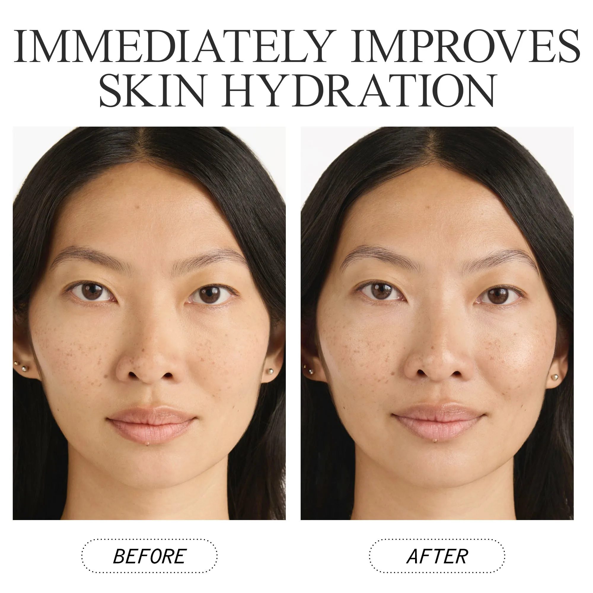 Anti-Wrinkle Cellular Routine