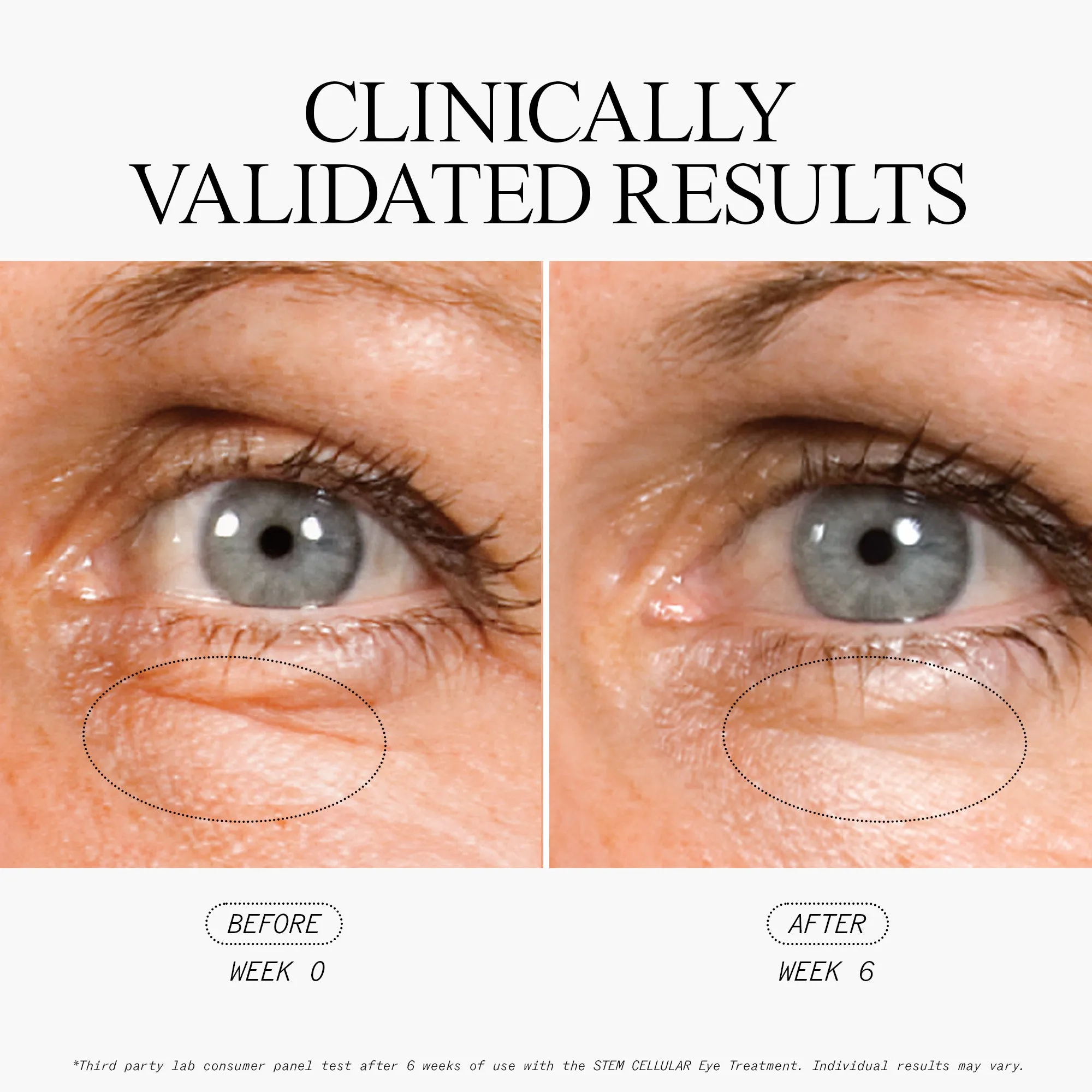 Anti-Wrinkle Cellular Routine