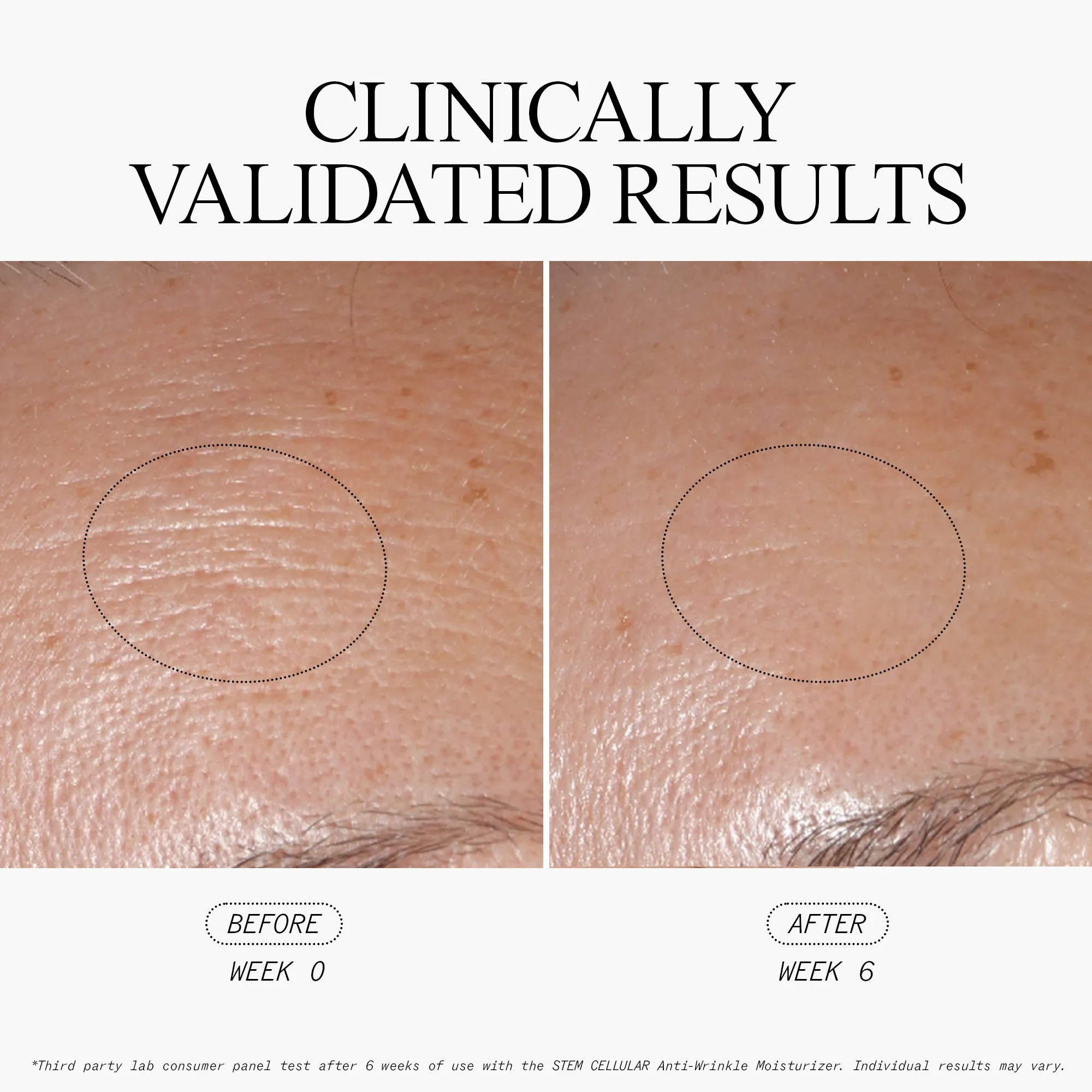 Anti-Wrinkle Cellular Routine