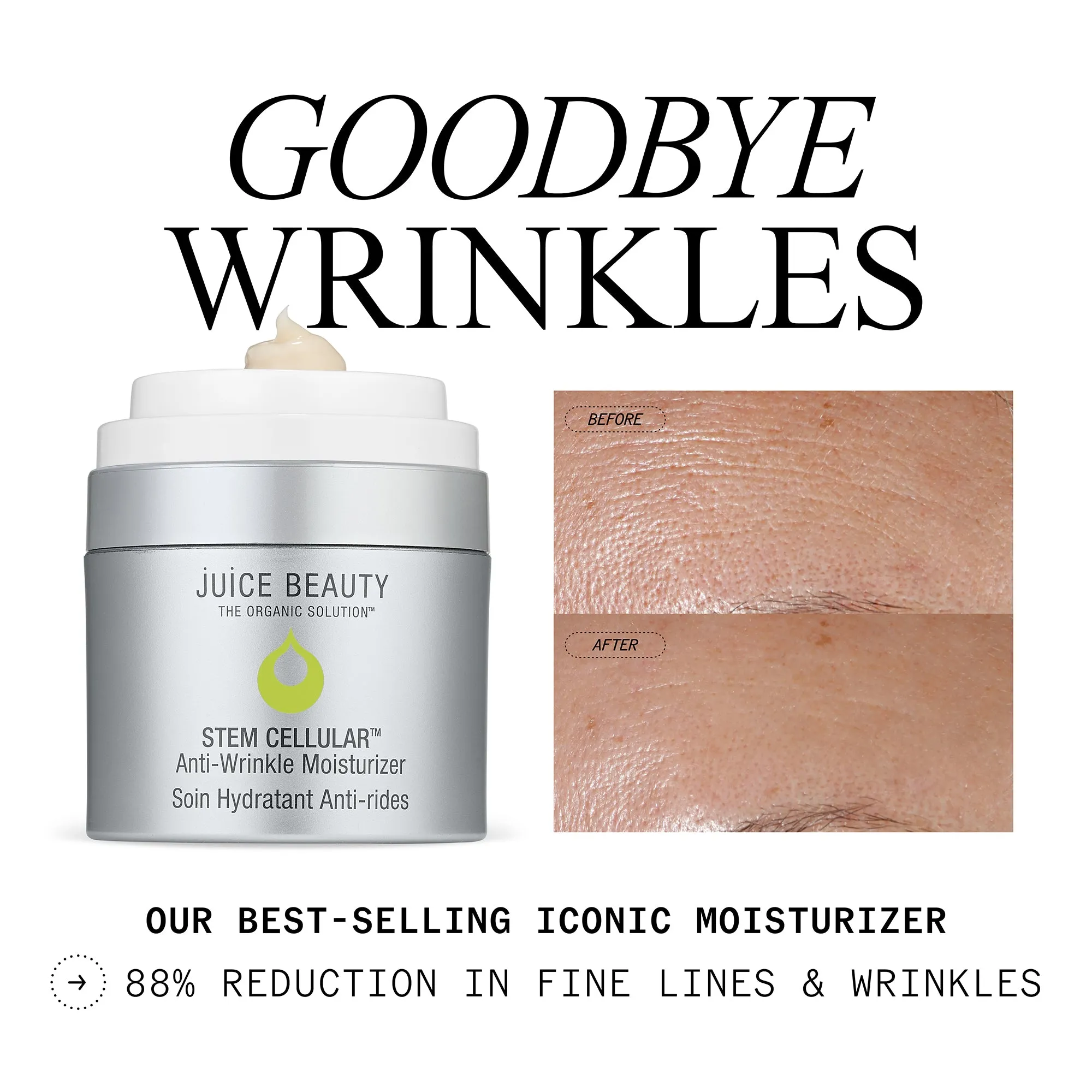 Anti-Wrinkle Cellular Routine