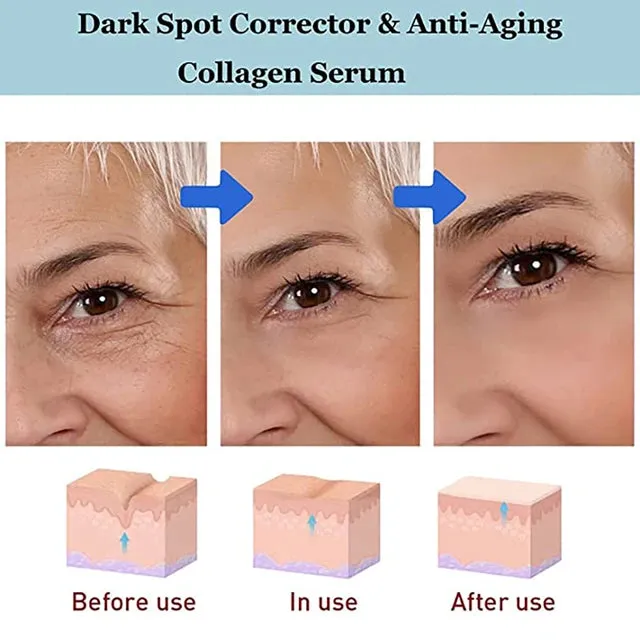 Anti-Wrinkle Eye Cream HYAKUON YouthRestore NMN Eye Cream Remove Dark Circle Eye Care Lifting Fade Eye Bag Eye Essence Cream