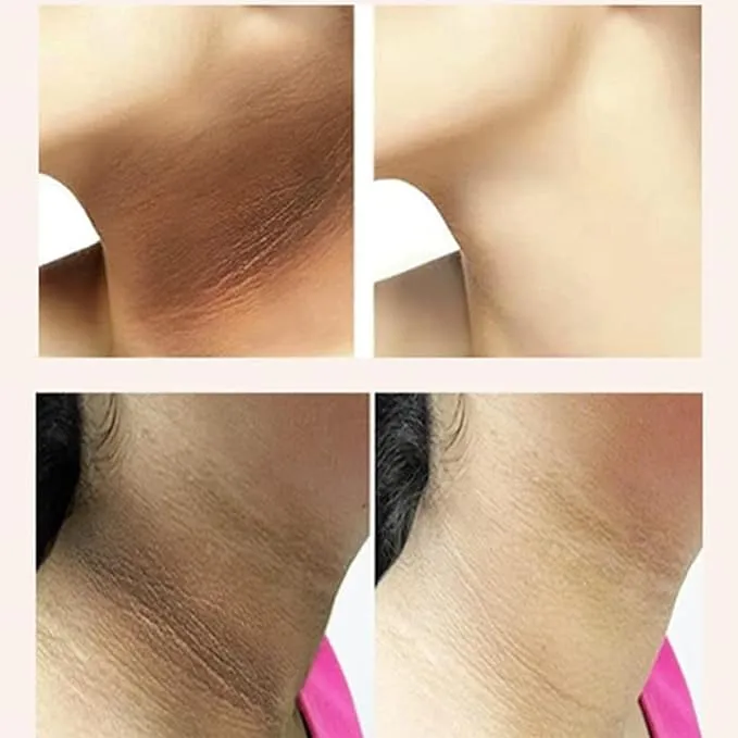 Brightening Neck Firming Cream - Double Chin Reducer Neck Tightener Cream - 20g