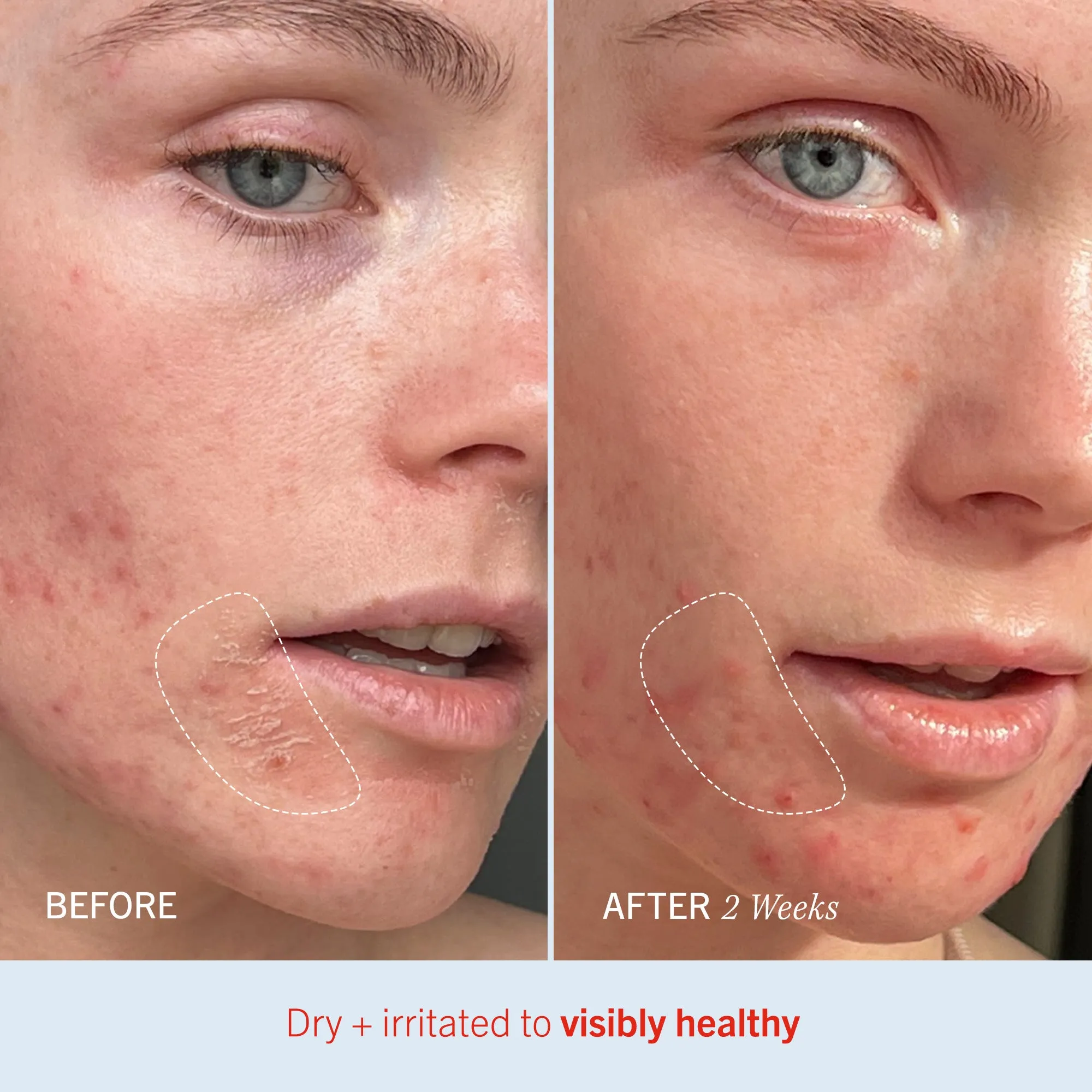 Bronze   Hydrate Duo