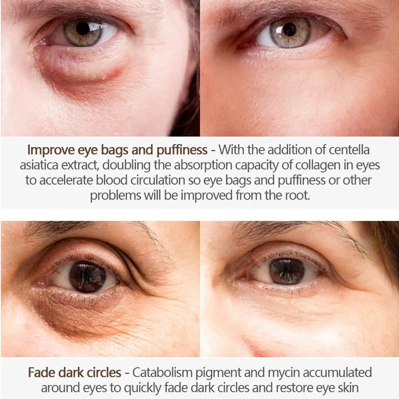 Crocodile Wrinkles Eye Cream Hyaluronic Acid Gel