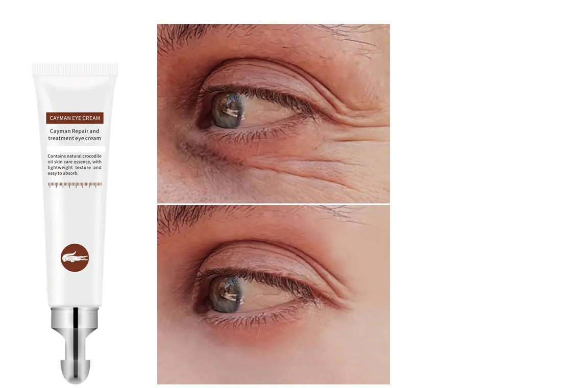 Crocodile Wrinkles Eye Cream Hyaluronic Acid Gel