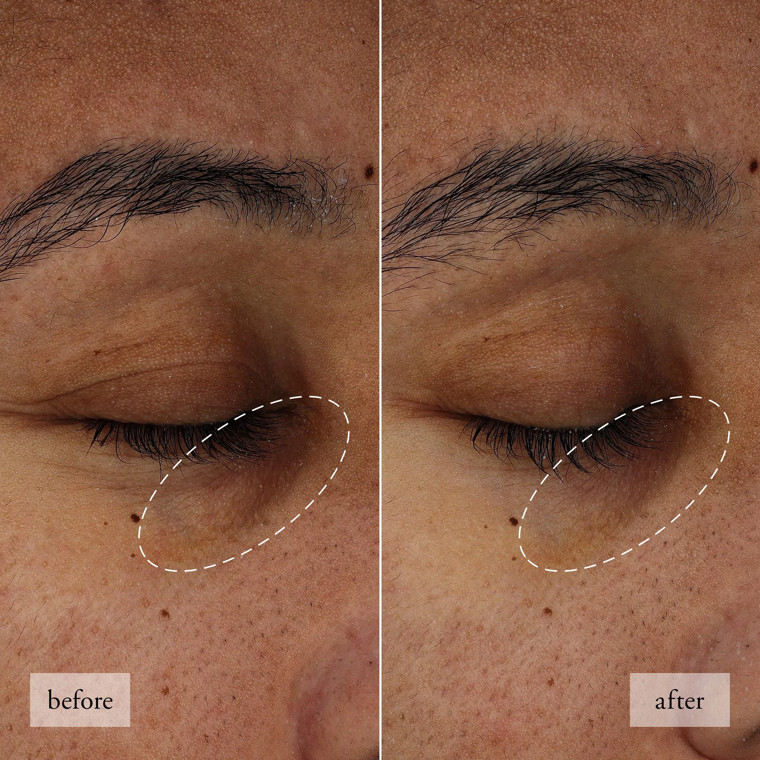 dark circle brightening eye cream