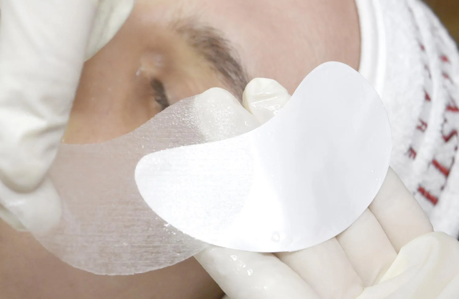 Dermastir Hyaluronic Post-op Mask Eye Lip Contour