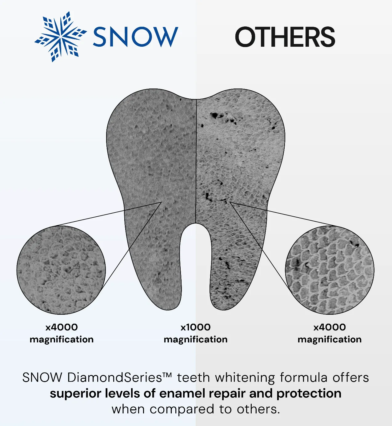 DiamondSeries® Teeth Whitening Kit with Hydroxyapatite & Potassium Nitrate