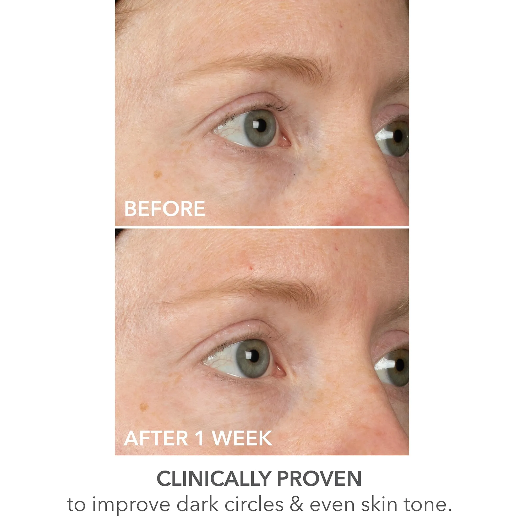 Dr Dennis Gross DermInfusions Lift   Repair Eye Mask | Visibily Lift   Firm, Fills the Appearance of Fine Lines, Deepy Hydrates   Repairs, Visibly Depuffs the Undereye Area | 4 Treatments