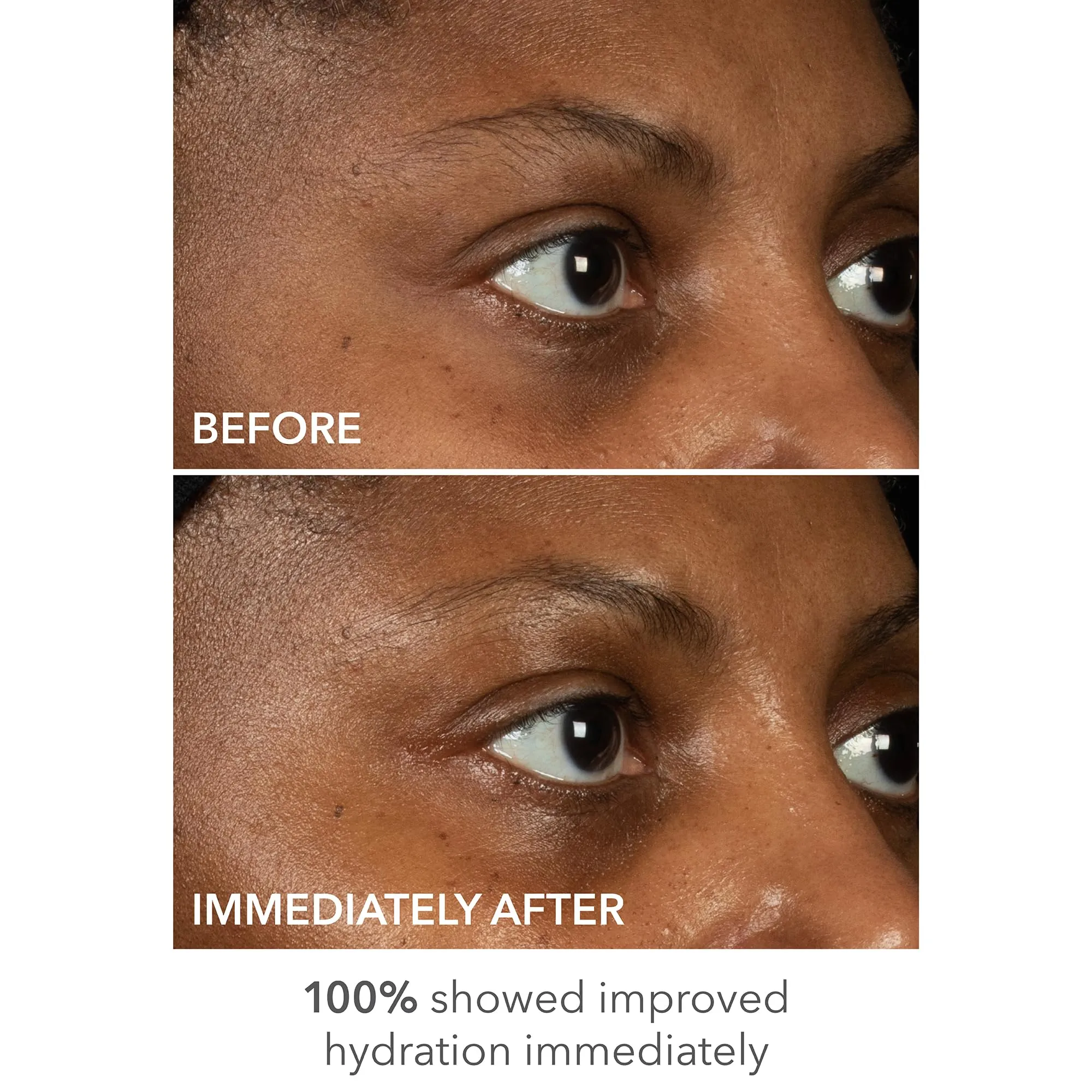 Dr Dennis Gross DermInfusions Lift   Repair Eye Mask | Visibily Lift   Firm, Fills the Appearance of Fine Lines, Deepy Hydrates   Repairs, Visibly Depuffs the Undereye Area | 4 Treatments