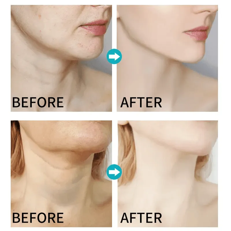 Dr.Rashel 5D Hyaluronic Acid Youth Revitalizing Neck Cream - 120g