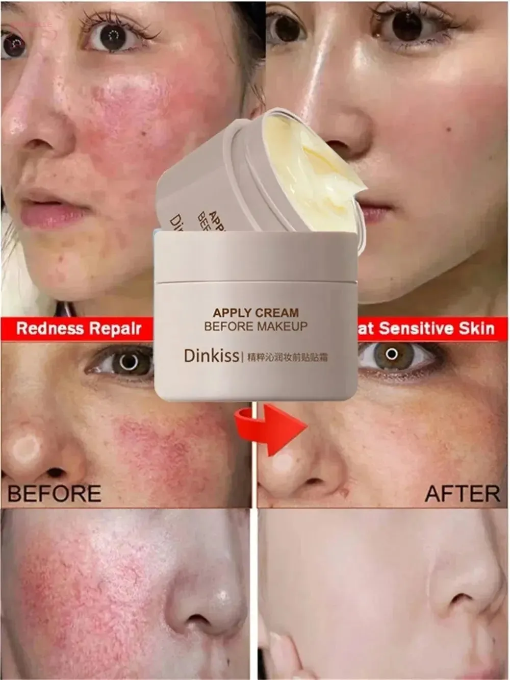 Facial Redness Repair Cream – Soothing & Hydrating Moisturizer for Sensitive Skin