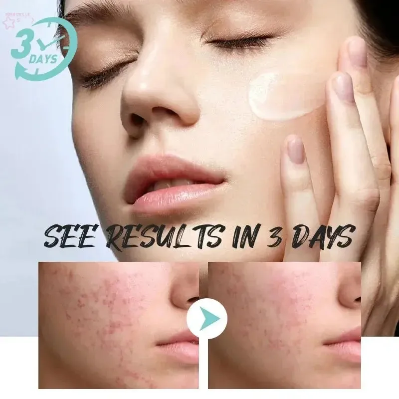 Facial Redness Repair Cream – Soothing & Hydrating Moisturizer for Sensitive Skin