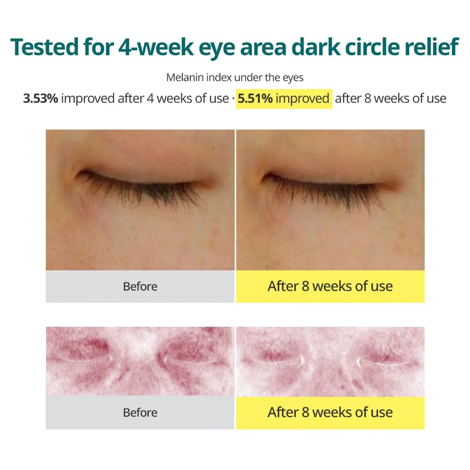 Goodal Green Tangerine Vitamin C Dark Circle Eye Cream 1.01oz/ 30ml