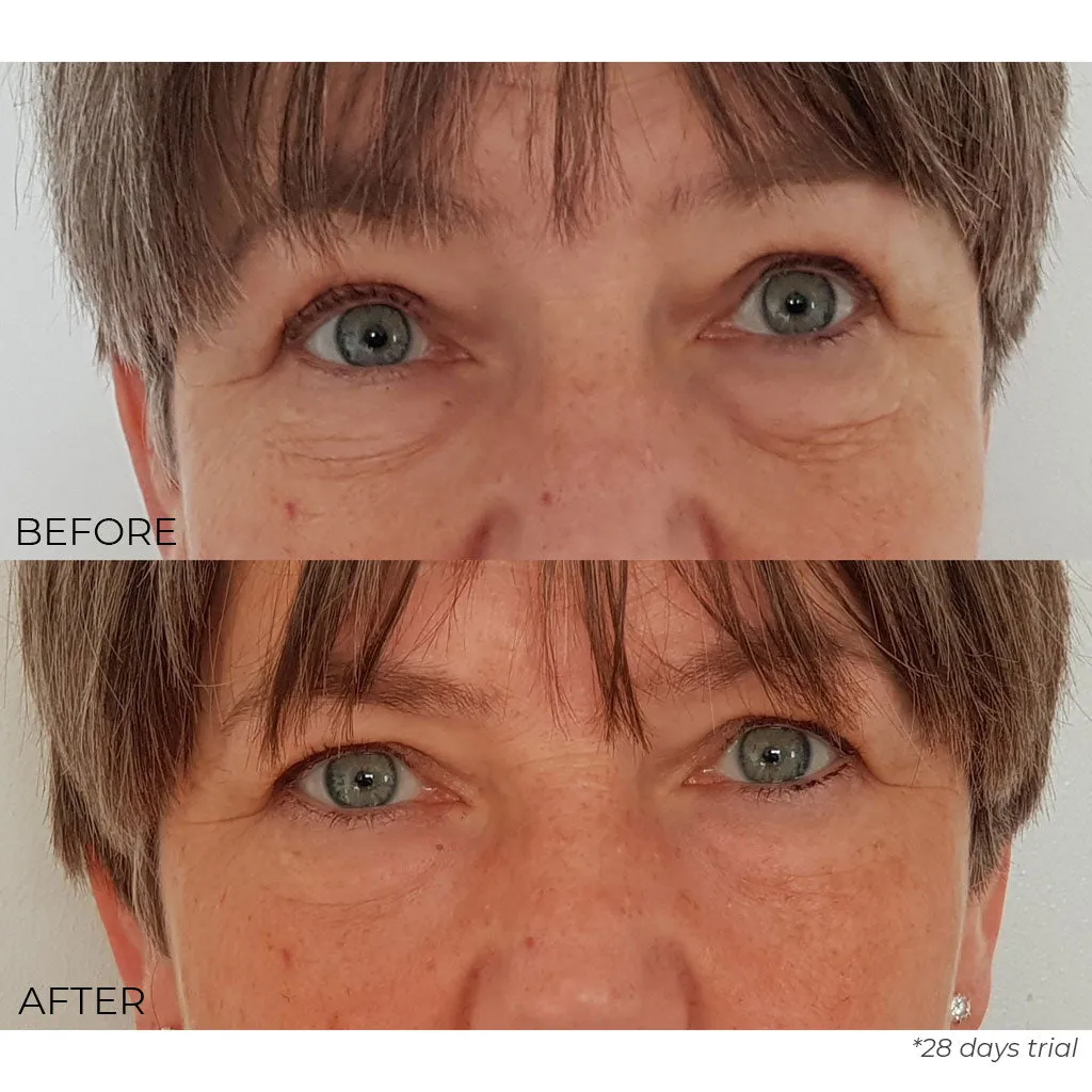 Kale Anti-Ageing Eye Cream