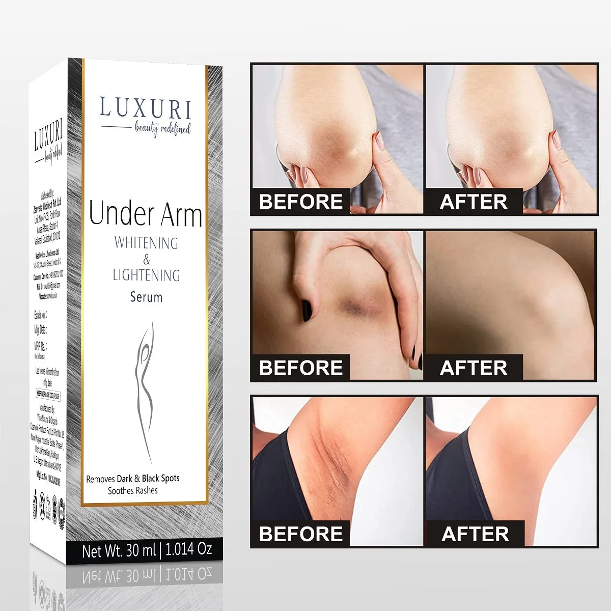 LUXURI Under Arms Whitening & Lightening Serum For Intimate Areas & Under Arms 30ml