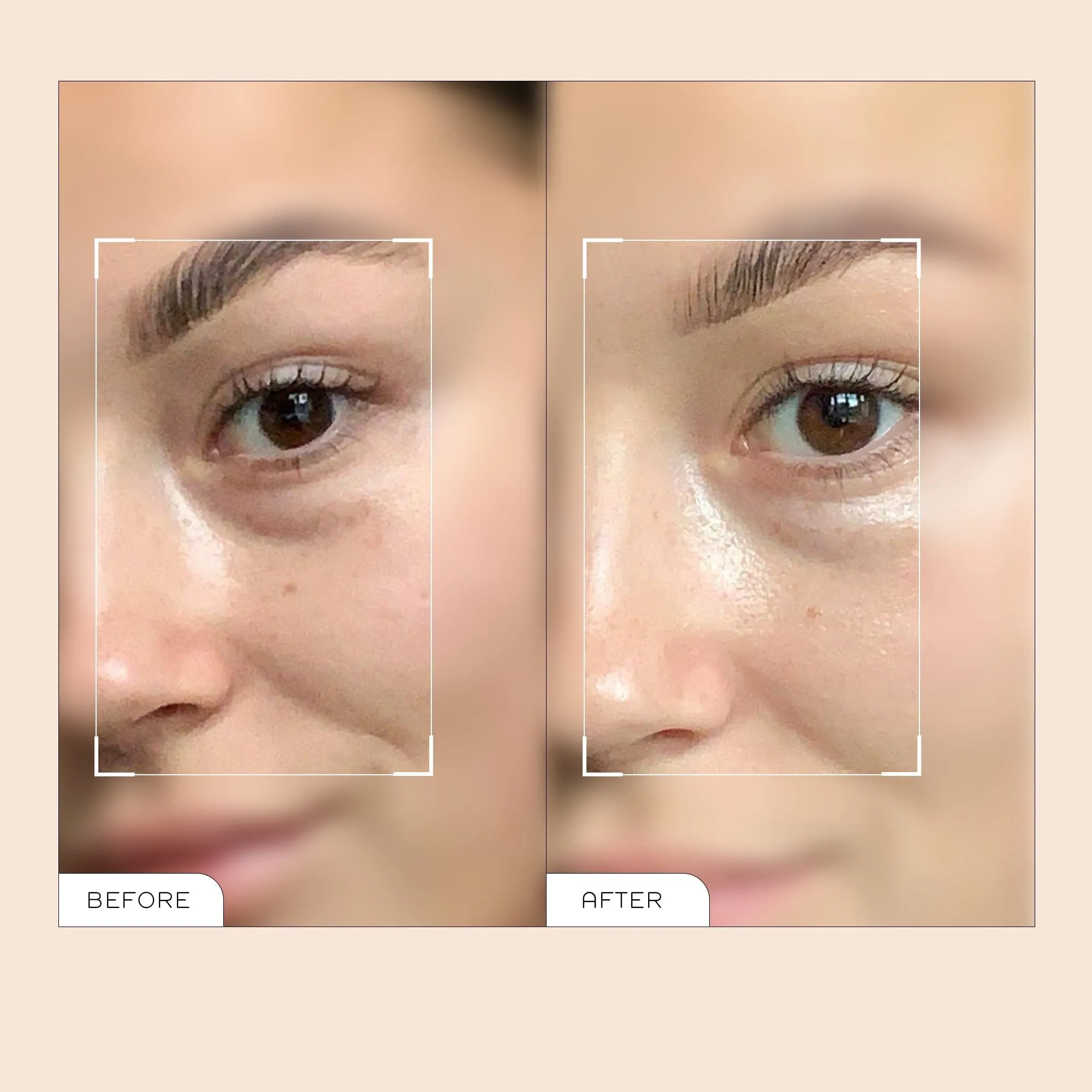 Mini Radiance Brightening Dark Circle Eye Cream