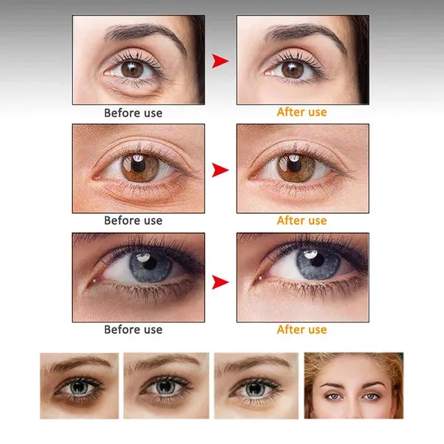 Moisturizing Eye Cream Naturally Lightens Fine Lines Anti-Aging Repair Wrinkles Remove Black Circles Brighten Eye Skin Care