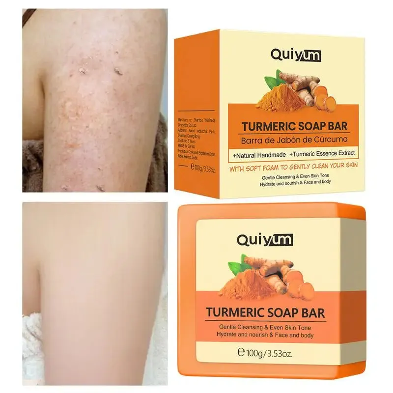 Natural Turmeric Soap Bar for Face and Body – Anti-Acne, Skin Whitening, and Dark Spot Removal