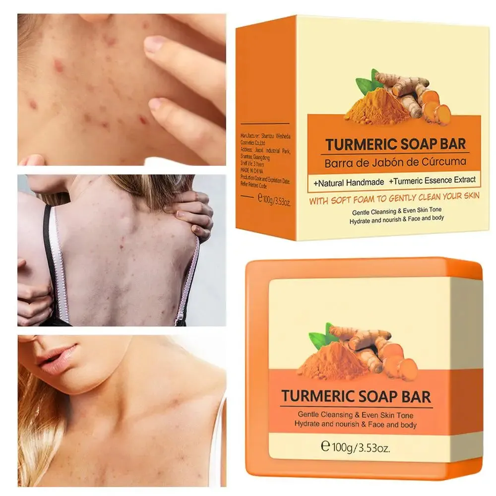 Natural Turmeric Soap Bar for Face and Body – Anti-Acne, Skin Whitening, and Dark Spot Removal