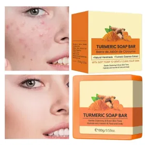 Natural Turmeric Soap Bar for Face and Body – Anti-Acne, Skin Whitening, and Dark Spot Removal