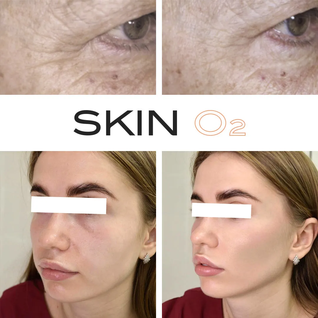 Peptide Eye Cream   Platinum Eyelift