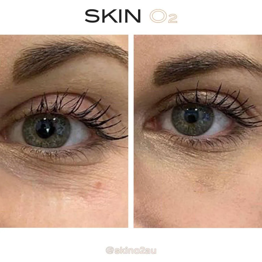 Peptide Eye Cream   Platinum Eyelift