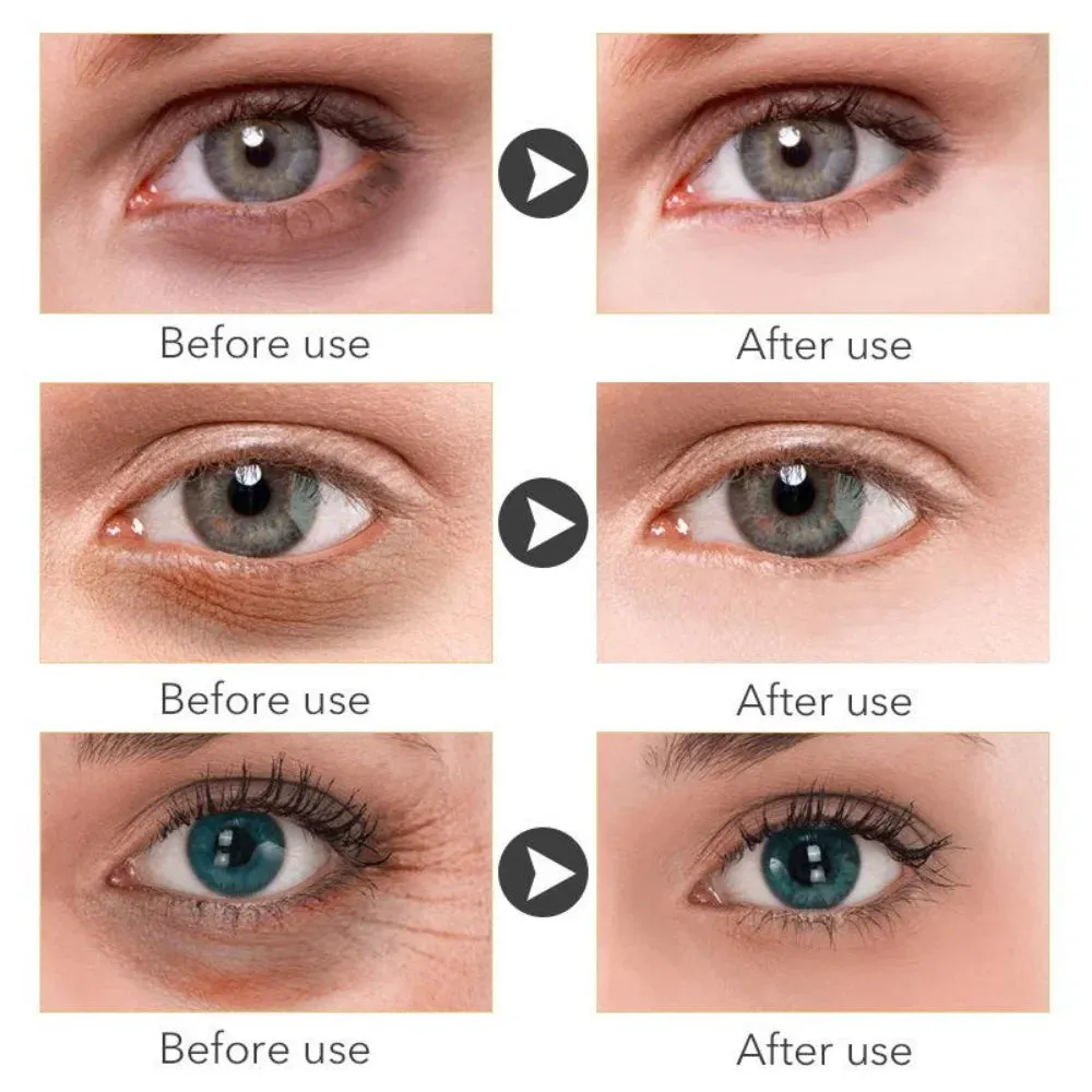 Retinol Anti-aging Whitening Serum