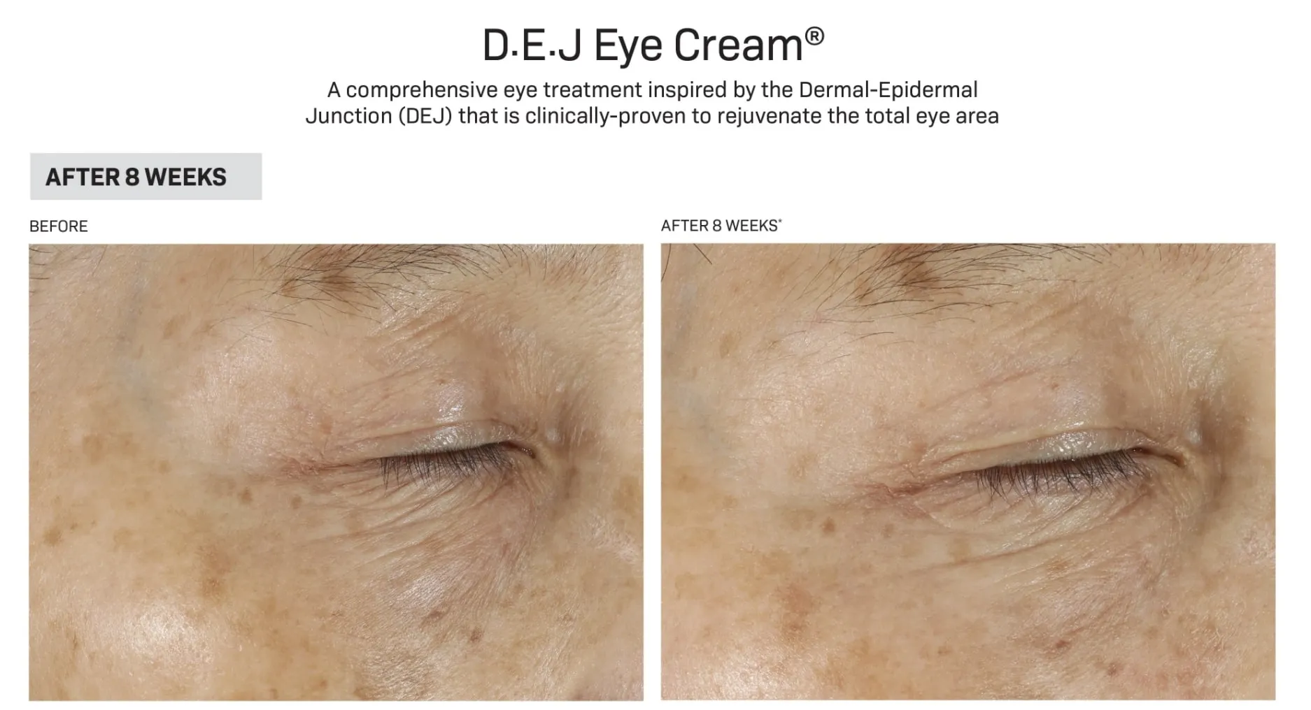 Revision DEJ Eye Cream