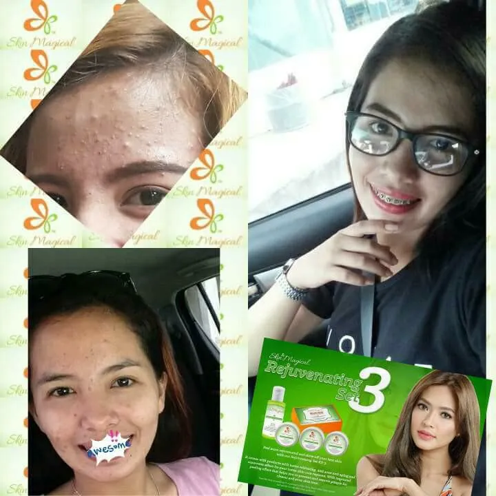 Skin Magical Rejuvenating Set No. 3