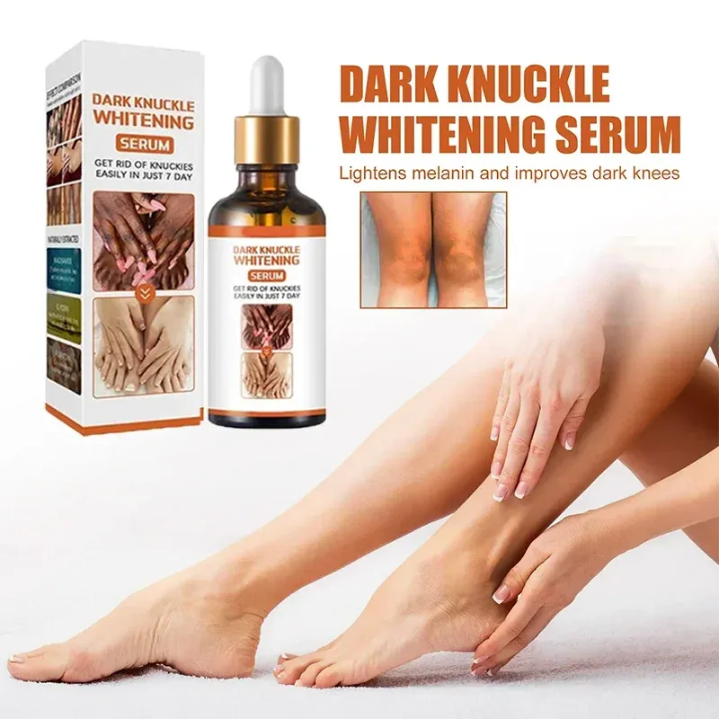 Skin Whitening Cream