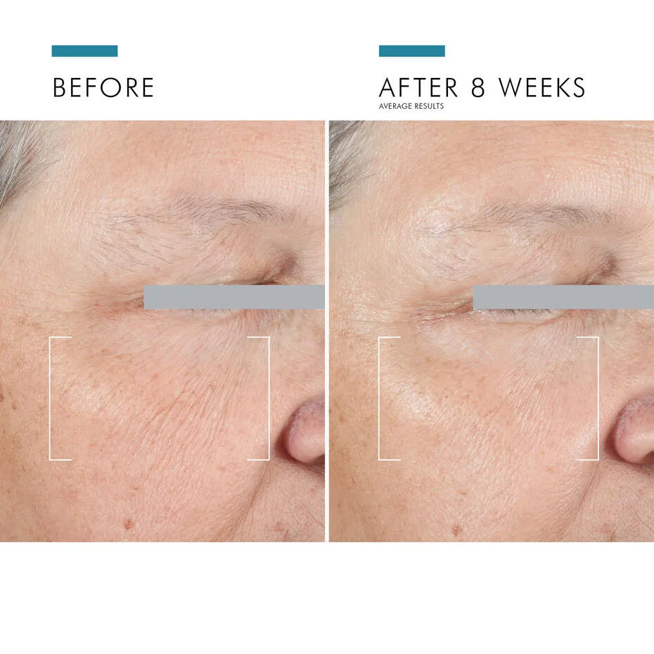 SkinCeuticals A.G.E Advanced Eye Complex 15ml