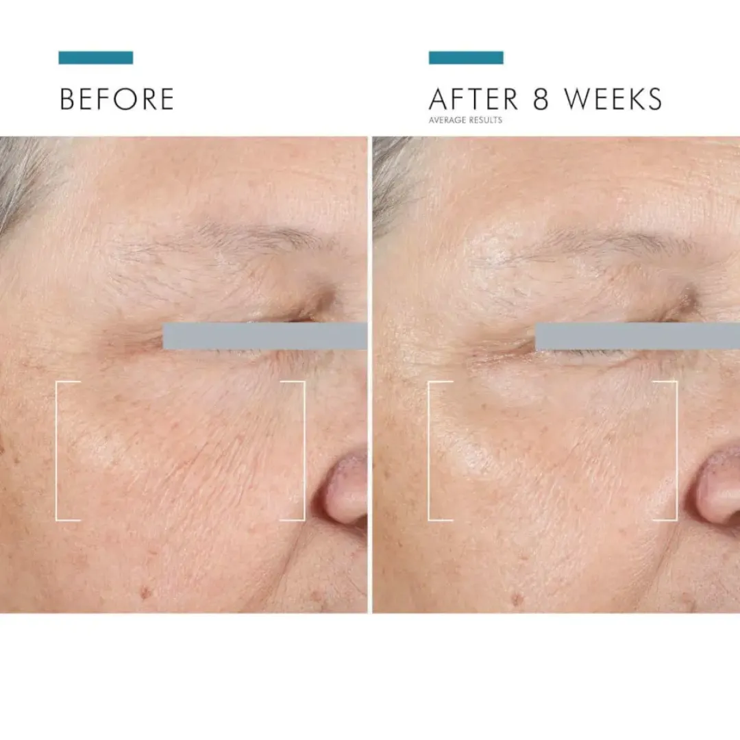 SkinCeuticals A.G.E. Advanced Eye