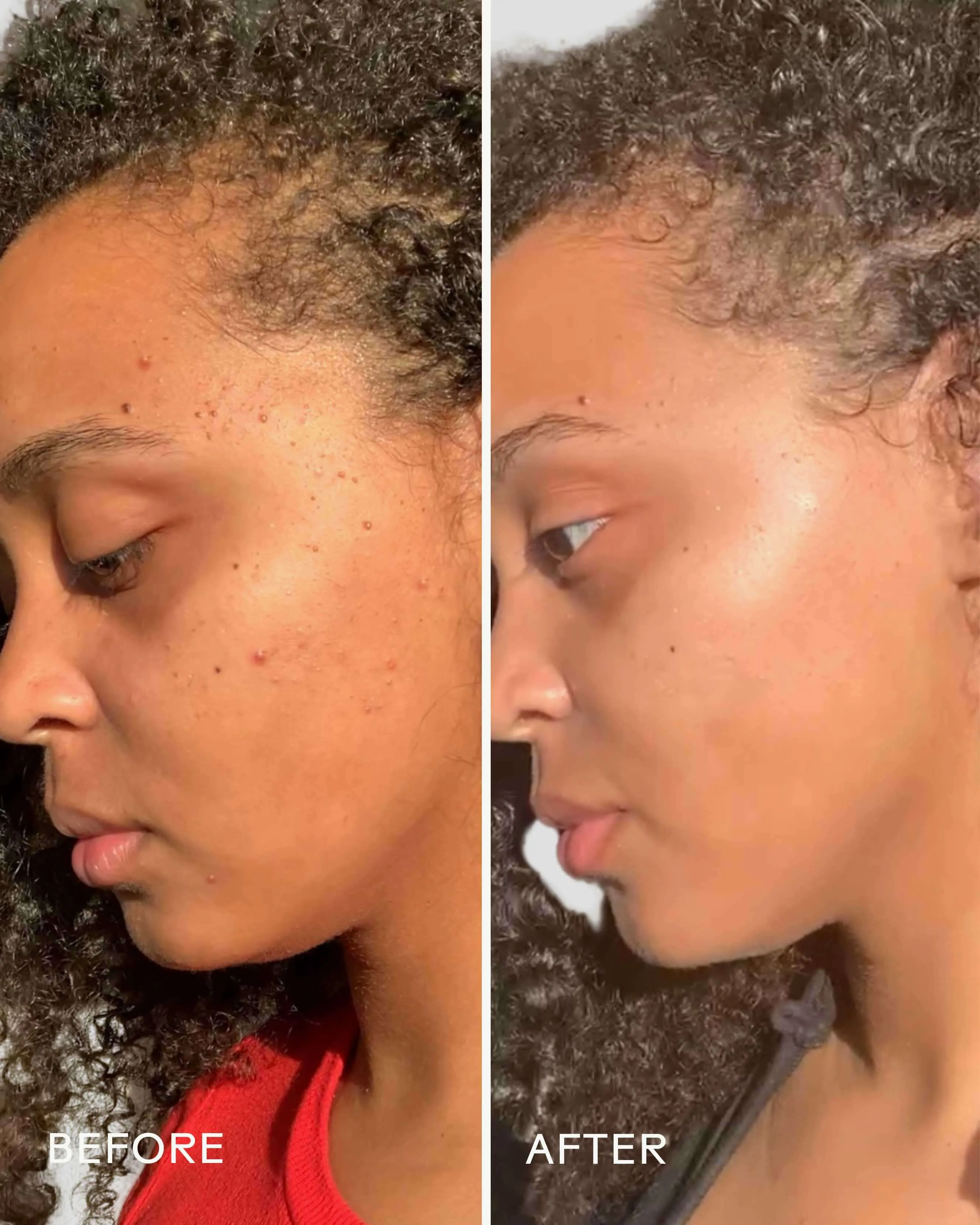 Superfruit Lactic   Multifruit 8% AHA Exfoliating Mask