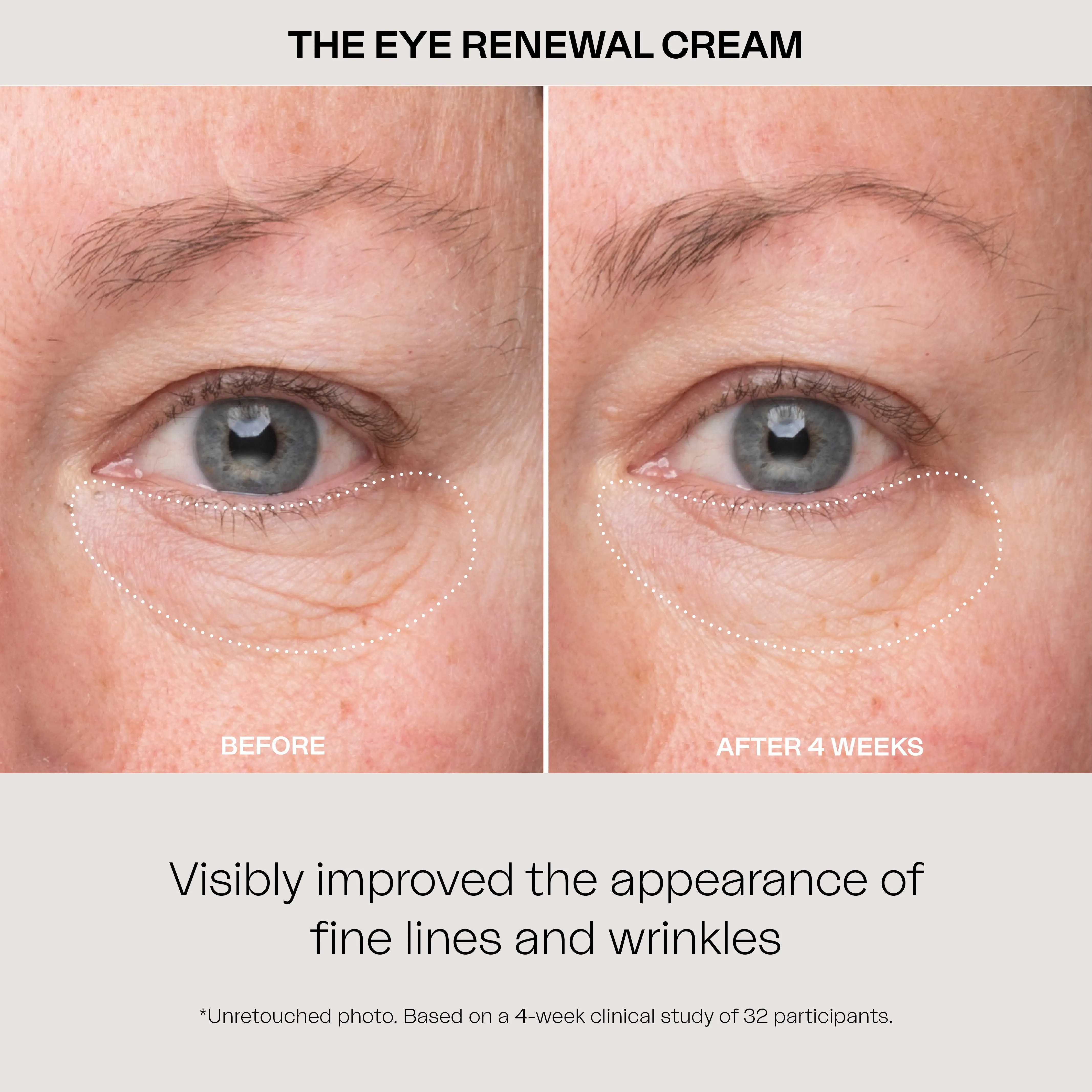 The Eye Renewal Cream
